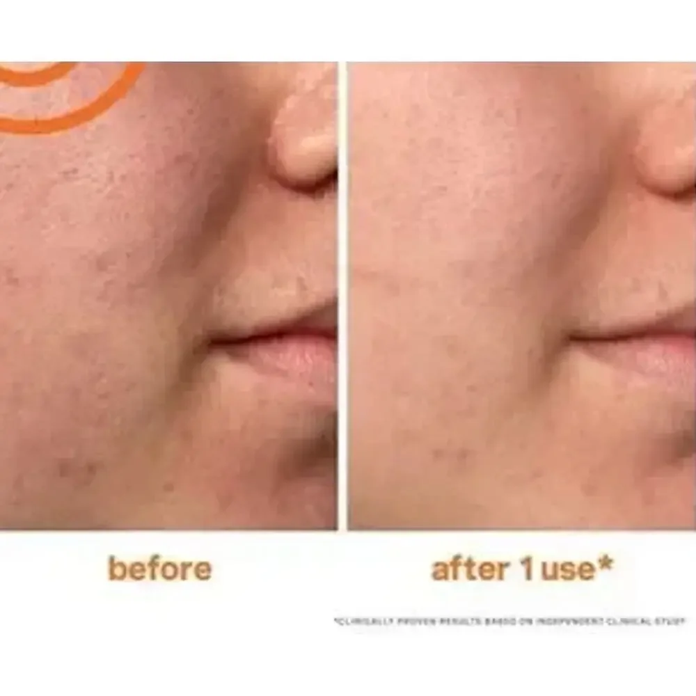 KATE SOMERVILLE NEW 2oz ExfoliKate Intensive Exfoliating Treatment Self Care Spa
